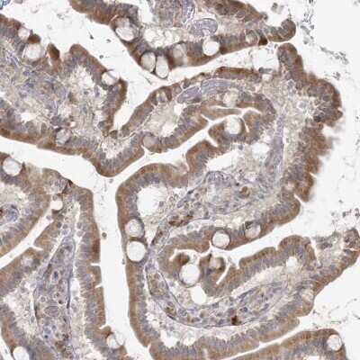 Immunohistochemistry: HPCL Antibody [NBP2-37877]