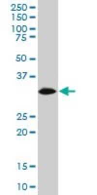 Western Blot: HADH Antibody (3C9) [H00003033-M02]