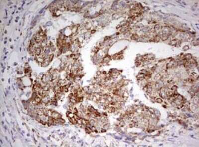 Immunohistochemistry: HADH Antibody (OTI3D12) [NBP2-45931]