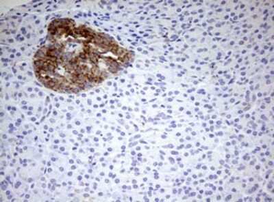 Immunohistochemistry: HADH Antibody (OTI3D12) [NBP2-45931]