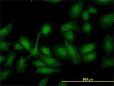 Immunocytochemistry/ Immunofluorescence: HADH Antibody (4B5) [H00003033-M01]