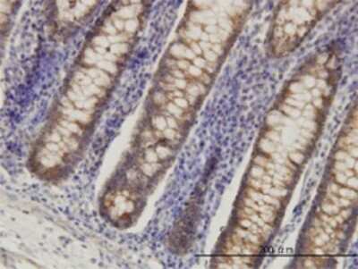 Immunohistochemistry-Paraffin: HADH Antibody (4B5) [H00003033-M01]