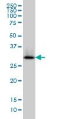 Western Blot: HADH Antibody (4B5) [H00003033-M01]