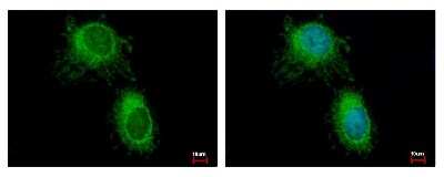Immunocytochemistry/ Immunofluorescence: HADH Antibody [NBP2-16776]