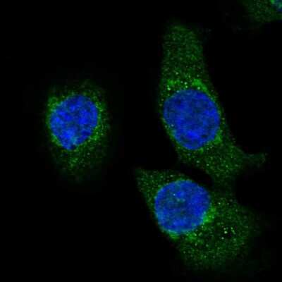 Immunocytochemistry/ Immunofluorescence: HADH Antibody [NBP2-55402]