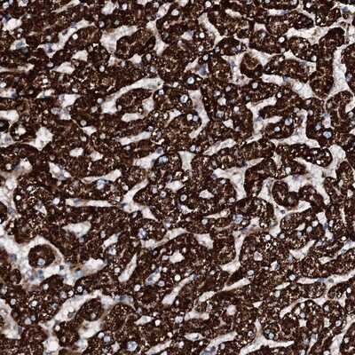 Immunohistochemistry-Paraffin: HADH Antibody [NBP1-83300]