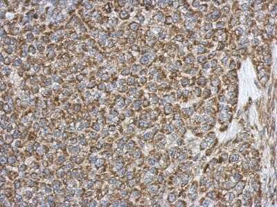 Immunohistochemistry-Paraffin: HADH Antibody [NBP2-16776]