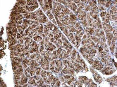 Immunohistochemistry-Paraffin: HADH Antibody [NBP2-16776]