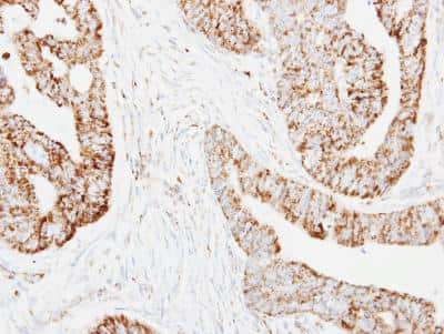 Immunohistochemistry-Paraffin: HADH Antibody [NBP2-16777]