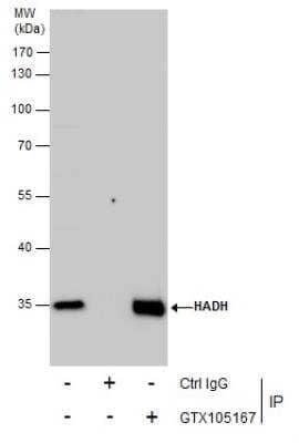 Immunoprecipitation: HADH Antibody [NBP2-16776]