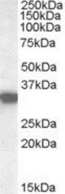 Western Blot: HADH Antibody [NB100-77343]