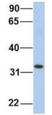 Western Blot: HADH Antibody [NBP1-54732]