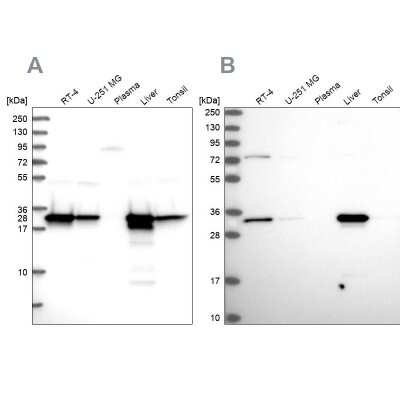 Western Blot: HADH Antibody [NBP1-83300]