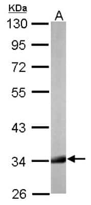 Western Blot: HADH Antibody [NBP2-16777]