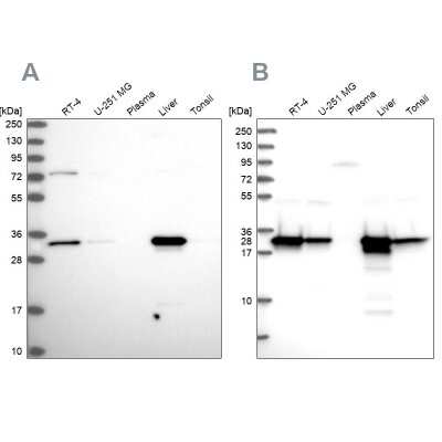 Western Blot: HADH Antibody [NBP2-55402]