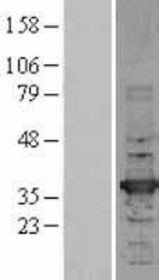 Western Blot: HADH Overexpression Lysate [NBL1-11435]