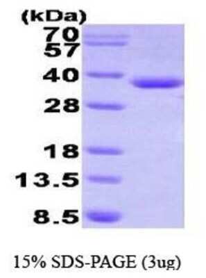 SDS-PAGE: Recombinant Human HADH His Protein [NBP1-41228]