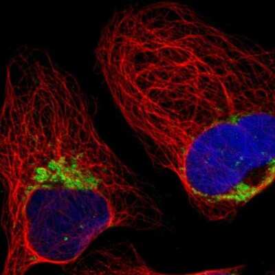 Immunocytochemistry/ Immunofluorescence: HADHA Antibody [NBP1-83387]
