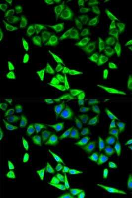 Immunocytochemistry/ Immunofluorescence: HADHA Antibody - BSA Free [NBP3-03743]