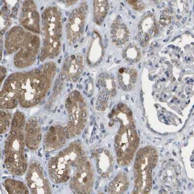 Immunohistochemistry-Paraffin: HADHA Antibody [NBP1-83387]