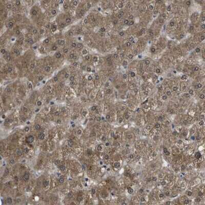 Immunohistochemistry-Paraffin: HADHA Antibody [NBP1-83387]