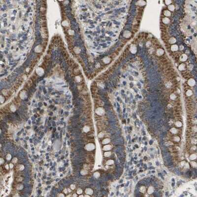 Immunohistochemistry-Paraffin: HADHA Antibody [NBP1-83387]