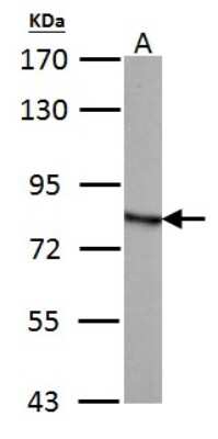 Western Blot: HADHA Antibody [NBP1-33588]