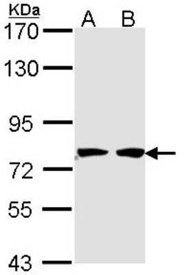 Western Blot: HADHA Antibody [NBP1-33588]