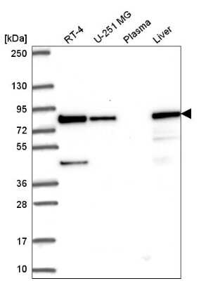 Western Blot: HADHA Antibody [NBP2-54988]