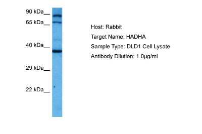 Western Blot: HADHA Antibody [NBP2-87551]