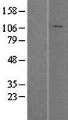 Western Blot: HADHA Overexpression Lysate [NBP2-04152]