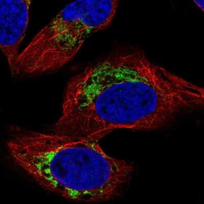 Immunocytochemistry/ Immunofluorescence: HADHB Antibody [NBP2-56259]