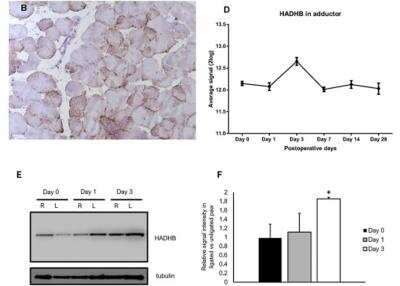 Immunohistochemistry: HADHB Antibody [NBP1-82609]