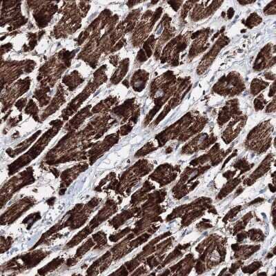 Immunohistochemistry-Paraffin: HADHB Antibody [NBP1-82609]