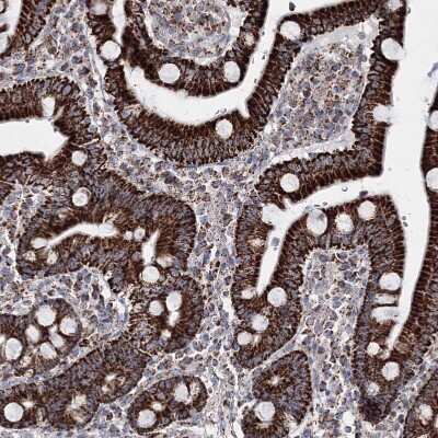 Immunohistochemistry-Paraffin: HADHB Antibody [NBP1-82609]
