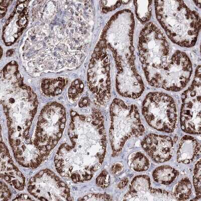 Immunohistochemistry-Paraffin: HADHB Antibody [NBP1-82609]