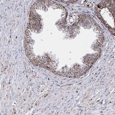Immunohistochemistry-Paraffin: HADHB Antibody [NBP1-82609]