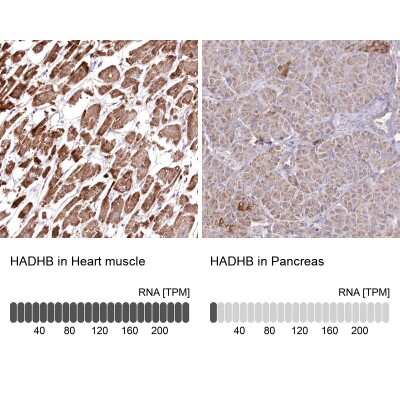 Immunohistochemistry-Paraffin: HADHB Antibody [NBP2-38353]