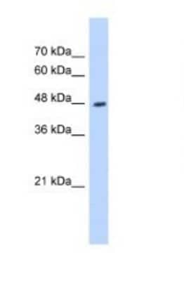 Western Blot: HADHB Antibody [NBP1-54750]