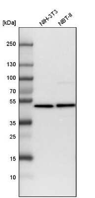 Western Blot: HADHB Antibody [NBP1-82609]