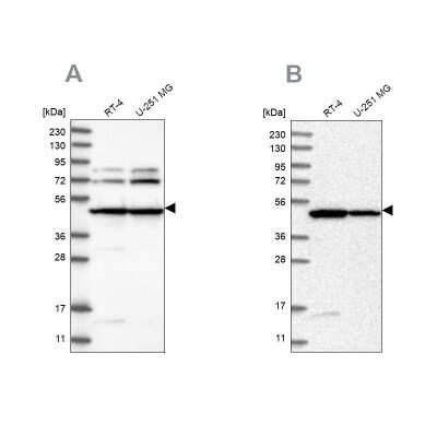 Western Blot: HADHB Antibody [NBP1-82609]