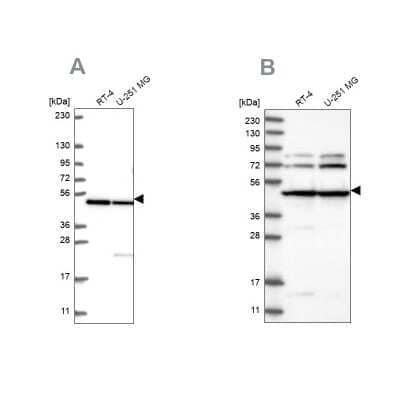 Western Blot: HADHB Antibody [NBP2-56259]