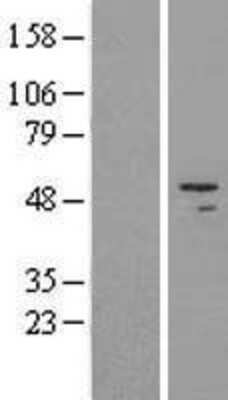 Western Blot: HADHB Overexpression Lysate [NBL1-11437]