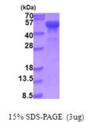 SDS-PAGE: Recombinant Human HADHB His Protein [NBP2-51948]