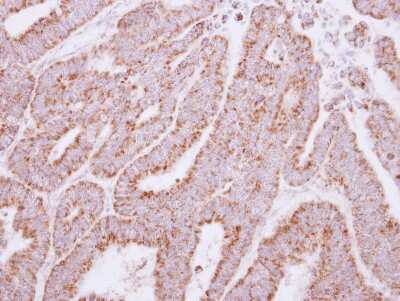 Immunohistochemistry-Paraffin: Glyoxalase II/HAGH Antibody [NBP2-16778]