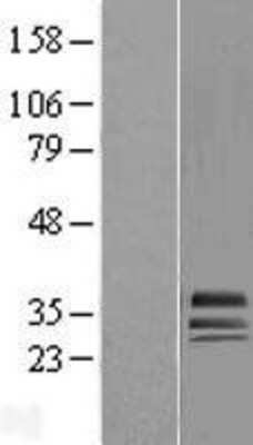 Western Blot: Glyoxalase II/HAGH Overexpression Lysate [NBL1-11438]