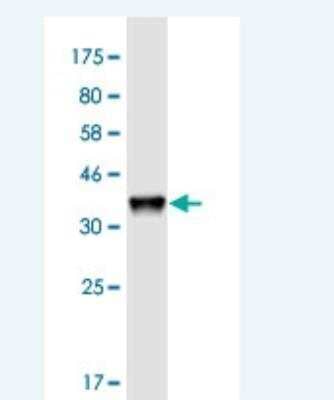 Western Blot: HAGHL Antibody (5B12) [H00084264-M01-100ug]