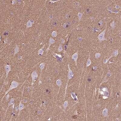 Immunohistochemistry-Paraffin: HAGHL Antibody [NBP2-68980]