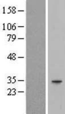 Western Blot: HAGHL Overexpression Lysate [NBL1-11439]