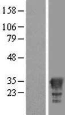 Western Blot: HAGHL Overexpression Lysate [NBL1-11440]